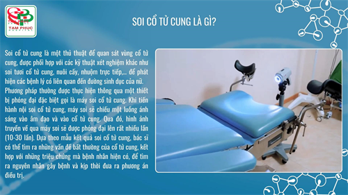 SOI CỔ TỬ CUNG – XUA TAN NỖI LO VỀ CÁC BỆNH LÝ LIÊN QUAN ĐẾN CỔ TỬ CUNG
